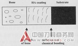 等离子弧喷涂生物医用涂层